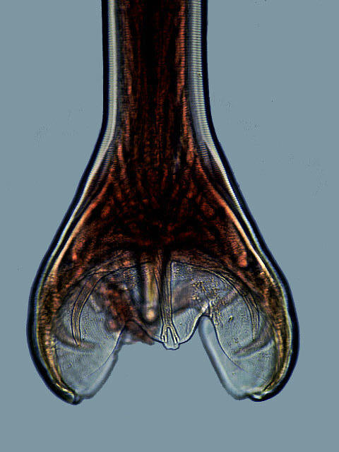 ancylostoma duodenale morphology