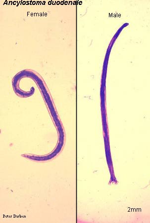 ancylostoma duodenale)